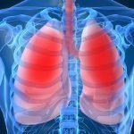 Occupational hygiene